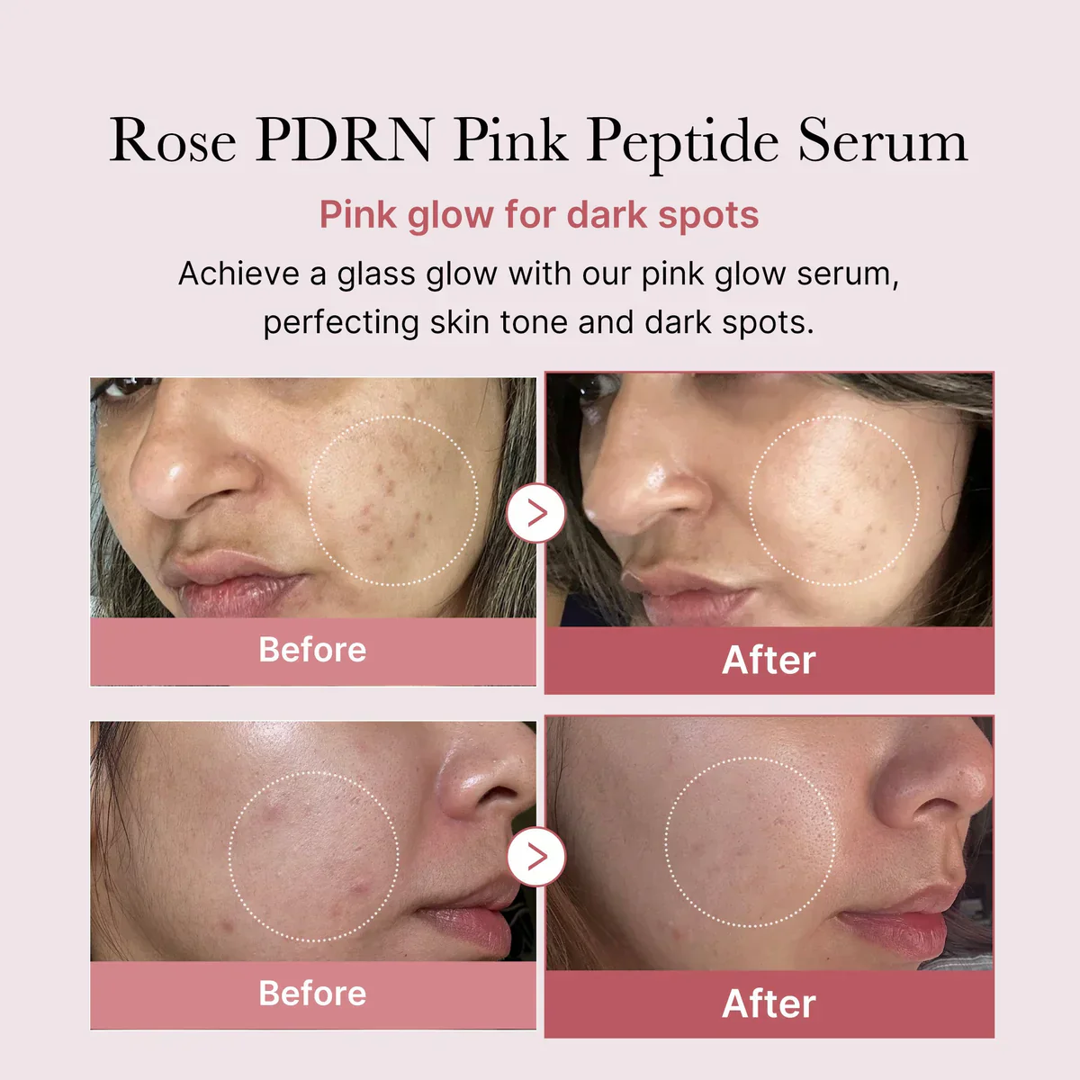 Medicube PDRN pdrn Pink Peptide Serum 30ml