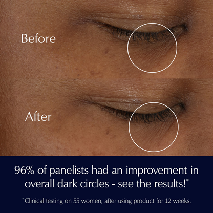 Estee Lauder Advanced Night Repair Eye Supercharged Gel-Creme