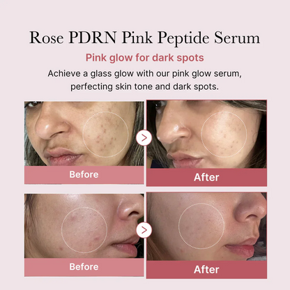 Medicube PDRN pdrn Pink Peptide Serum 30ml
